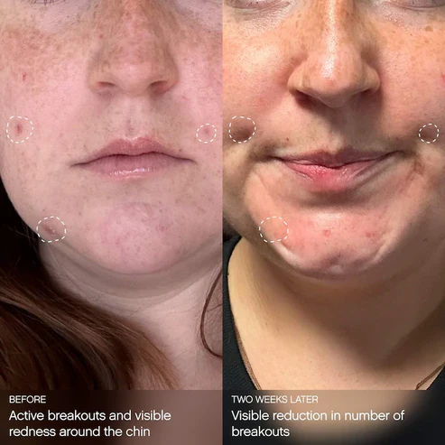 عکس از ماسک topicals صورت